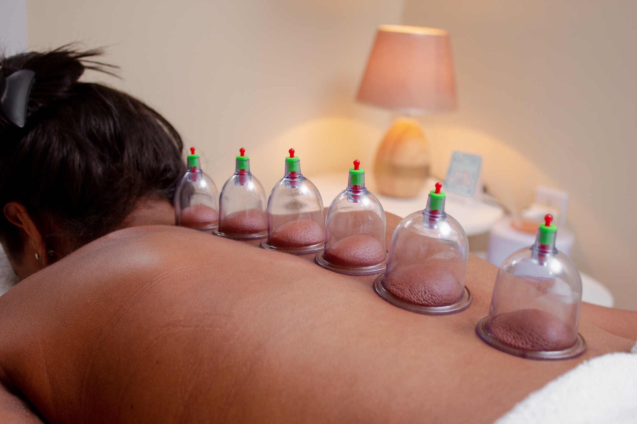 Cupping: glazen cups op de rug van een cliënte